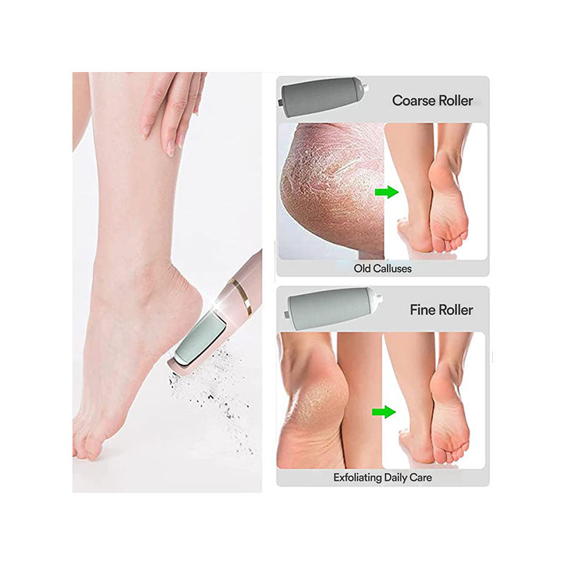 Callus Remover